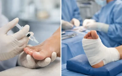 Injections Versus Foot Surgery: Which Helps?