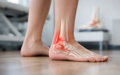 Posterior Tibial Dysfunction and Painful Flat Feet