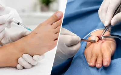 Cortisone Versus Neuroma Excision Compared