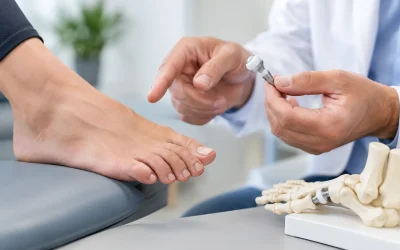 When Are Toe Joint Implants the Right Option?